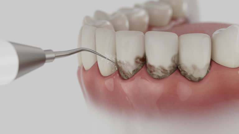 Trusted Dental Crowns And Bridges service in Red Oak, TX - Dentist Open Now